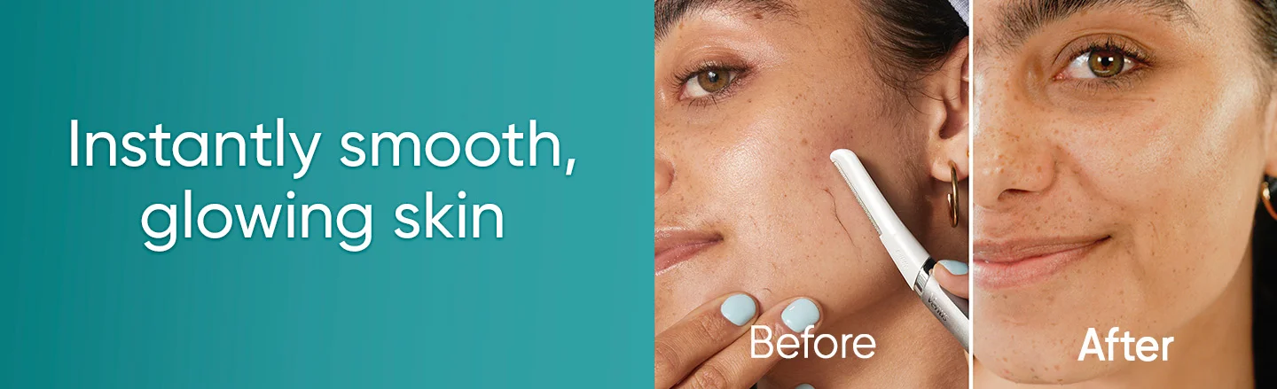 Instantly smooth glowing skin, Venus Dermaplaning Before and After faces displayed